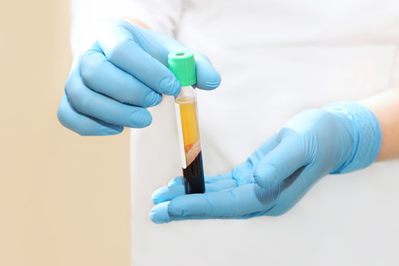 What is Platelet-Rich Plasma? - 